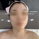 수스킨케어 | 에스테틱 처음 받아봤어용예.🫧 일산 피부관리 성미스킨케어 후기