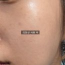 한주할인마트 | 2026 군대 px 추천템 비타 라이트 리들샷 100 300 700 군마트 화장품 리스트 총정리