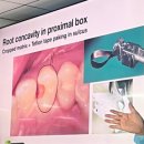 벤처세라믹치과기공소 | [치과세미나] 원데이 간접수복세미나 후기