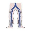 청주연세의원 | 청주하지정맥류 과잉진료 피하고 싶다면 [필독]