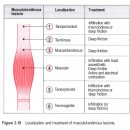 힘줄 질병의 이해 tenosynovitis, tendinopathy(tendinitis, tendinosis)의 구분 이미지