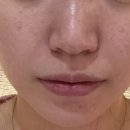 쁨글로벌의원 이미지