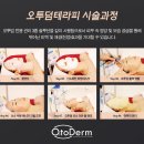 오투테라피