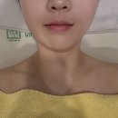 코코온누리약국 | 강남역에스테틱 [에스테틱공간] 성형경락 후기