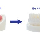 스타일치과기공소 이미지