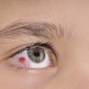 안경캐슬 이미지