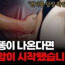 이런똥이 나온다면 최장암이 시작됐습니다// 검은 콩의 두얼굴 이미지