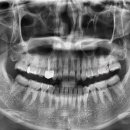 의정부본플란트치과의원 이미지
