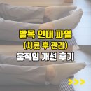 창원 용호동 유핏_발목 인대 파열 움직임 개선 후기&amp;자주 접질리는 발목 필라테스로 관리하기
