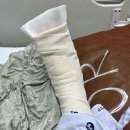 진자동차병원 | 교통사고 발 실금 골절 입원 후기 (ft. 전치 5주) | 자동차보험 대인접수 진단서 종합 박애병원