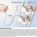 Postherpetic neuralgia. 포진후 동통. 병리 탐구!! 이미지