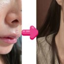 레드문글로벌 이미지