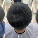 다솜헤어라인