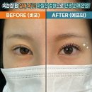 울산속눈썹펌 실패? 삼산동 탐나네에서 쌍꺼풀 끼임 완벽 복구한 리얼후기!