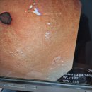 광주속편한내과의원 | [광주북구 위내시경] 매곡동 속편한내과에서 내시경후기