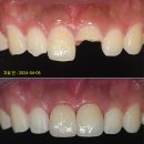 네오연세치과의원 네이버블로그