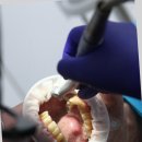 엘투치과의원 | 양치질의 중요성과 생활습관 가운데 치과 선택 요령