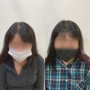 안산두피문신 후기, 자연스러운 변화 직접 느껴요