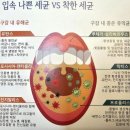 망포동 치과-왜 첫키스는 더 달콤할까?(fea. 구강세균의 비밀)