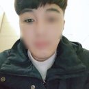 연세비비의원 | 오타모반치료후기? 이건 경험해봐야 압니다.