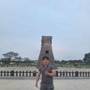 신세계연합의원 | 대구 옥포 싸나히 한식로이더 [후기] 대구 옥포 신세계연합의원 점 제거 받았어요 (경과, 회복 사진 포함)