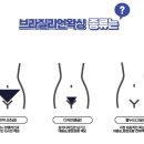 왁싱남녀 이미지