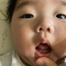 10개월 아기 유치 불소도포 후기 하남 그린소아청소년과의원