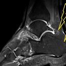 어깨사랑마취통증의학과의원 이미지