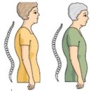 물리치료사의 바디포스쳐 PT 이미지