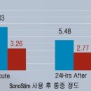 엠디케이 (MDK) 이미지