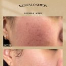 기가메디칼 이미지