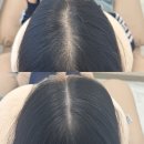 수원가르마커버는 로기smp 리얼 찐후기