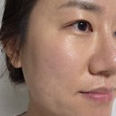 리플리 | 기미잡티개선에 좋은 닥터리플리 나이아10플러스 다크 스팟 세럼 후기