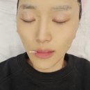 샬롬의료재단 | 아산배방에스테틱| 건조한계절 뷰마르에서 아쿠아수분케어로 수분 가득 충전했어요.