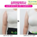 톡스미의원