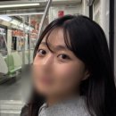 청하약국 | 눈밑지방재배치 + 안와지방이식 내돈내산 발품 &amp; 수술후기 (사진많음주의)