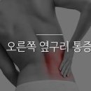 오른쪽 옆구리 통증 병원 등 부위 아픈 이유 이미지