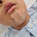 더나눔병원 | 아이 턱밑 찢어짐 봉합수술 후기 더나눔병원 진짜 ‘더 나눔’이었던 순간