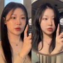 라임 | 청담동 울쎄라피프라임 300샷 후기 30대(울쎄라 붓기, 울쎄라 부작용)