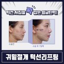 매하관 네이버블로그