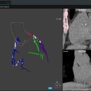 라인소프트 이미지