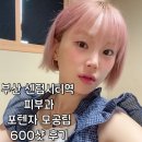 시티피부과의원 | 부산 센텀시티역 피부과 포텐자 모공팁 600샷 시술 후기 통증 효과 다운타임 관리 내돈내산