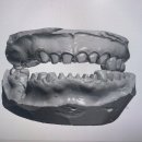 부여치과기공소 이미지