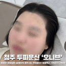 차헤어 - 양주시 삼숭로38번길 20 | 청주 두피문신 잘하는 곳 추천 가경동 오니브 헤어라인 2회차 내돈내산 찐 후기