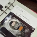 심해진 | 임신 9~10주차 입덧 심해진 시기｜입덧약 늘린 후기