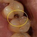 퍼스트 치과기공소 이미지