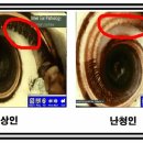 좋은소리 보청기 이미지