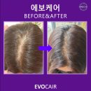 주식회사 킹케어 이미지