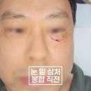 강동실비 이미지