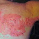 굿모닝힐의원 이미지